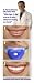 White Light - Teeth Whitening System