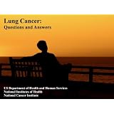 Lung Cancer: Causes, Symptoms, Signs, Diagnosis, Treatments, Stages. What You Need to Know About Lung Cancer