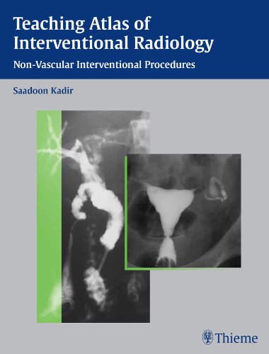 Teaching Atlas of Interventional Radiology: Non-Vascular Interventional Procedures (Teaching Atlas Series)