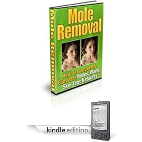 "How to Completely Remove Moles and Warts Naturally!"