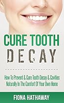 Cure Tooth Decay: How To Prevent & Cure Tooth Decay & Cavities Naturally In The Comfort Of Your Own Home (Cure Tooth, Cure Tooth Decay, Tooth Decay Cure,  Whitening, Teeth Health, Teeth Healing)