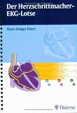 Der Herzschrittmacher-EKG-Lotse