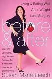 Before and After: Living and Eating Well After Weight Loss Surgery
