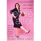 Click here to buy Before and After: Living and Eating Well After Weight Loss Surgery by Susan Maria Leach.