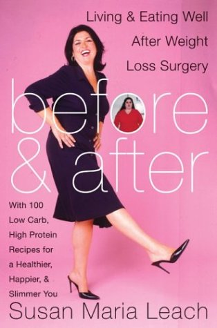 gastric bypass before and after