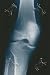Art Poster, Knee - 18.75 x 27.5