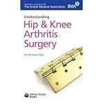 Understanding hip and knee arthritis surgery