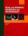 Fetal and Neonatal Neurology and Neurosurgery