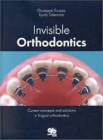 Invisible Orthodontics: Current Concepts and Solutions in Lingual Orthodontics