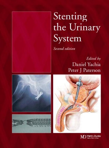 excretory system in humans. the Urinary System,