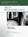 Written by leading experts from the Mayo Clinic, this volume of our Orthopaedic Surgery Essentials Series presents all the information residents need on hip, knee, shoulder, and elbow reconstruction in adults. It can easily be read cover to cover during a rotation or used for quick reference before a patient workup or operation. The user-friendly, visually stimulating format features ample illustrations, algorithms, bulleted lists, charts, and tables. Coverage of each region includes physical evaluation and imaging, evaluation and treatment of disorders, and operative treatment methods. The extensive coverage of operative treatment includes primary and revision arthroplasty and alternatives to arthroplasty.