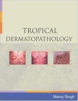 Tropical Dermatopathology