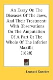 An Essay On The Diseases Of The Jaws, And Their Treatment: With Observations On The Amputation Of A Part Or The Whole Of The Inferior Maxilla (1828)