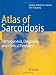 Search : An Atlas of Sarcoidosis