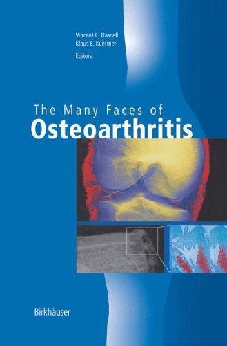 The Many Faces of Osteoarthritis (Methods and Tools in Biosciences and Medicine) On Sale