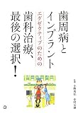 歯周病とインプラント エグゼクティブのための歯科治療、最後の選択!
