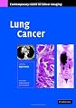 Lung Cancer (Contemporary Issues in Cancer Imaging)