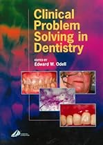 Clinical Problem Solving in Dentistry, 1e