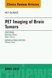 PET Imaging of Brain Tumors