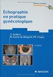 Echographie en pratique gynécologique