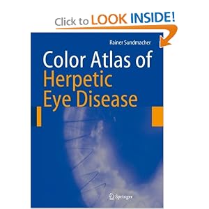 412a9jXC9tL. BO2,204,203,200 PIsitb sticker arrow click,TopRight,35, 76 AA300 SH20 OU01  Color Atlas of Herpetic Eye Disease: A Practical Guide to Clinical Management 