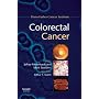 Colorectal Cancer: Dana-Farber Cancer Institute Handbook (Dana-Farber Cancer Institute Handbooks)