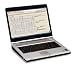 PCH-200 Expert Holter System.Includes PC 17 monitor laser printer Holter Software 1 HR-300 Holter R