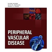 Dx/Rx: Peripheral Vascular Disease