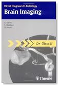 Brain Imaging (Direct Diagnosis in Radiology)