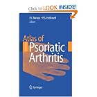Click here to buy Atlas of Psoriatic Arthritis by Philip J. Mease and Philip S. Helliwell.