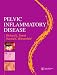 Pelvic Inflammatory Disease