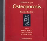 Osteoporosis