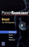 PocketRadiologist Breast - 100 Top Diagnoses Print Version