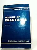 Outline of fracture : including joint injuries