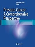 Prostate cancer : a comprehensive perspective