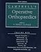 Campbell's Operative Orthopaedics 4 Volume Set