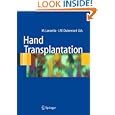 Hand transplantation