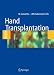 Hand transplantation