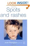 Spots and Rashes