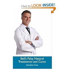 Bell's Palsy Natural Treatments and Cures by Johnathan Porter