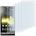 6 x mumbi Displayschutzfolie Sony Xperia S Displayschutz CrystalClear unsichtbar - NICHT Sony Ericsson Xperia ARC / Xperia ARC S