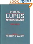 Systemic Lupus Erythematosus
