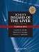 Schiff's Diseases of the Liver (2 Volume Set)