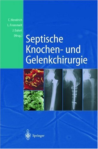 Septische