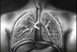 Historic Tuberculosis Films DVD: History of Pulmonary & Mycobacterium TB & Lung Disease Films