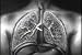 Historic Tuberculosis Films DVD: History of Pulmonary & Mycobacterium TB & Lung Disease Films