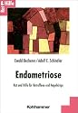 Endometriose. Rat und Hilfe für Betroffene und Angehörige