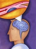Diagram of Brain Aneurysm Photographic Poster Print, 24x32