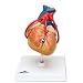 3B Scientific G05 2 Part Classic Heart with Bypass Model, 4.7" Length x 4.7" Width x 7.5" Height
