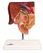 gallstones15  - 3B Scientific Gallstone Model